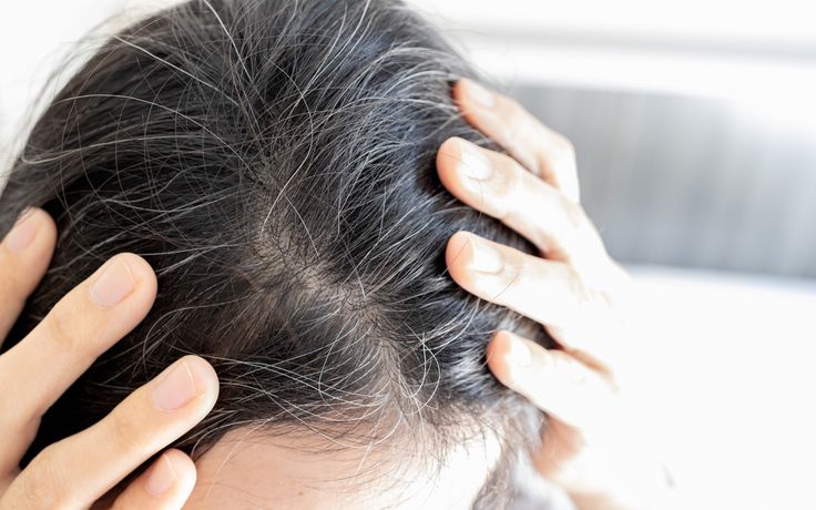 How Can I Slow Down Hair Graying? Let's learn from Dermatologists!